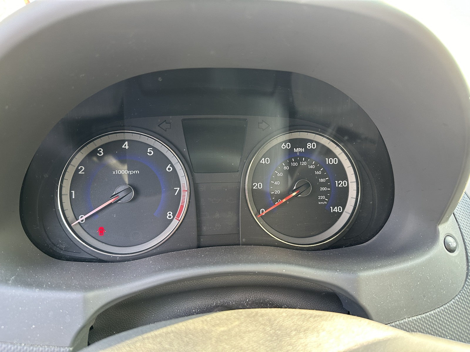 Anti-lock Brake Parts HYUNDAI ACCENT 15 16 179